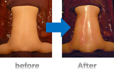 千葉市,緑区,あすみが丘,マッサージ,頭痛,肩こり,腰痛,便秘,アトピー,喘息,産後骨盤矯正,妊活,不妊,ダイエット,美容矯正,スタイル改善,小顔,痩身,ボディーライン,フェイシャルエステ,脱毛,デトックス,猫背,O脚,交通事故,トレーニング